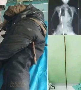 Young Man Hospitalized After Arrest Raises Questions About Custody Procedures and Public Safety